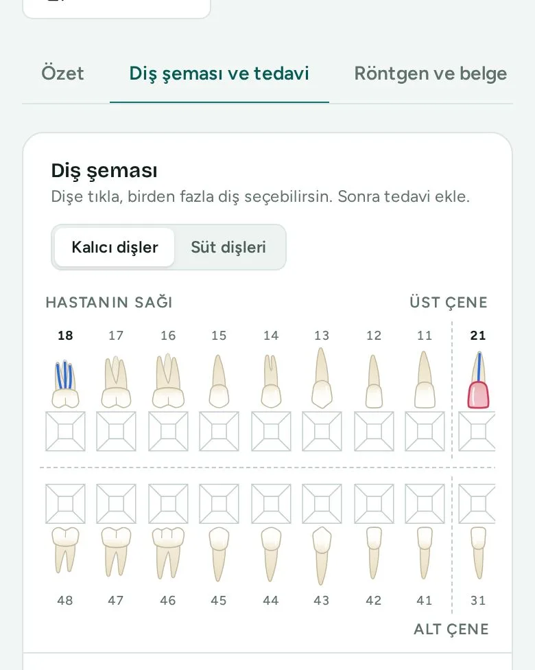 Telefonda diş şeması